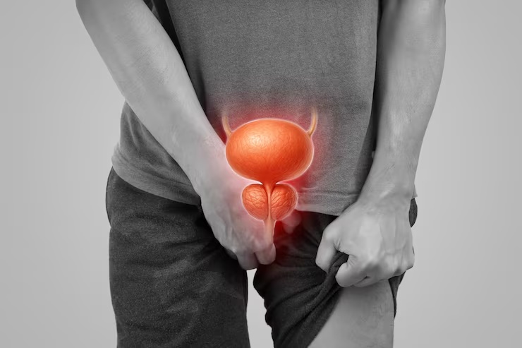 Prostate Health